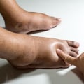 Expert Tips for Diabetic Foot Care: Protecting Your Feet and Overall Health