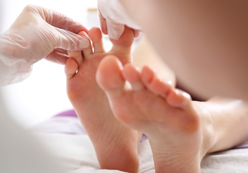 Preventing Diabetic Foot Ulcers: Early Warning Signs to Look Out For