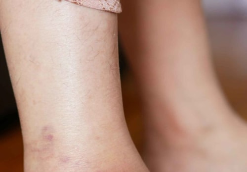 The Importance of Early Detection and Management of Diabetes in Your Feet